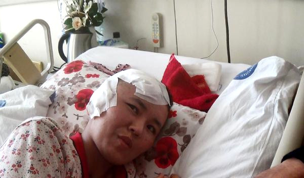Fuhşa Zorlanıp Öldüresiye Dövülen Kırgız Kadın 58 Gün Sonra Taburcu Oldu