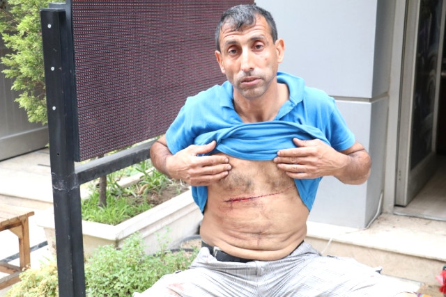 Antalya’da Bıçaklı Kavgada Taraflar Tekrar Karşı Karşıya Geldi: 1’i Ağır 5 Yaralı